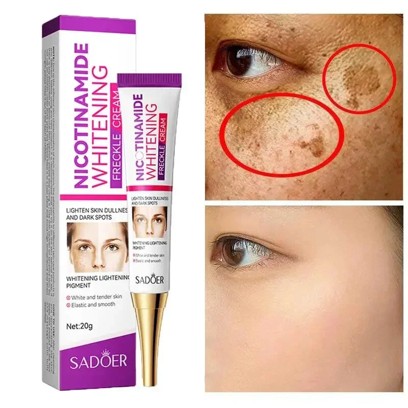 2024 New 3Pcs Niacinamide Whitening Freckle Cream Effectively Removes Melasma Lightens Black Spots Acne Marks Brightens Skin Care