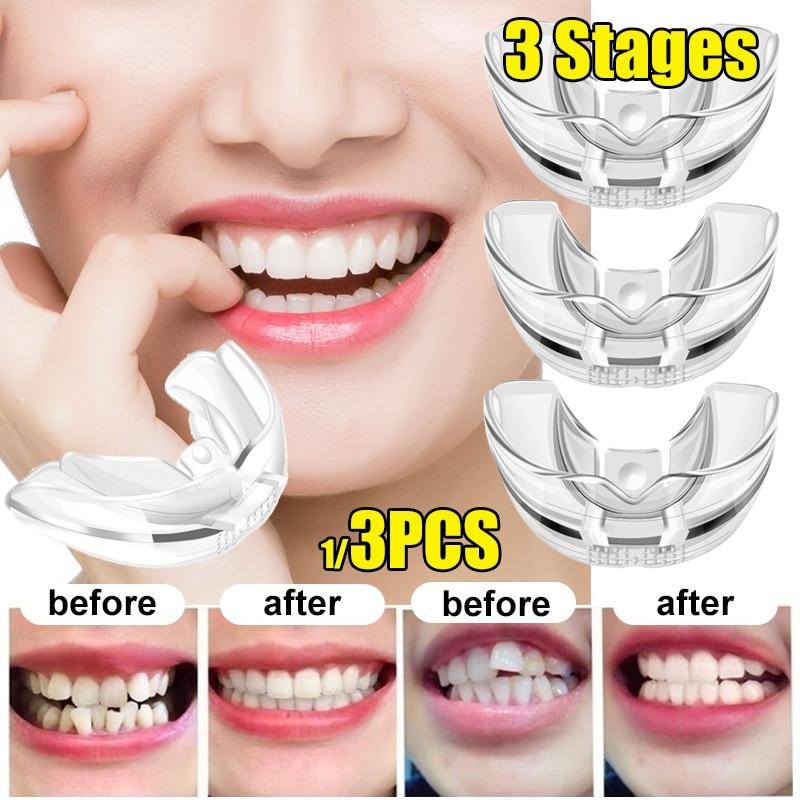 1pc / 1set Tooth Orthodontic Trainer Dental Tooth Appliance Alignment Brace Silicone Material Professional Guard TeethStraightener